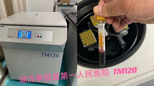 Latest company news about Centrigue PRP